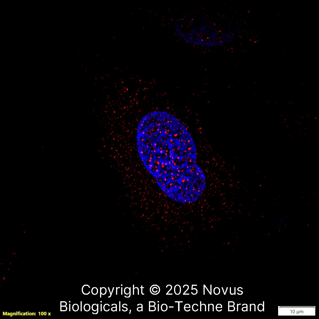 FANCD2 Antibody [DyLight 550]