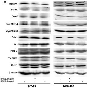 PARP2 Antibody - Unpurified