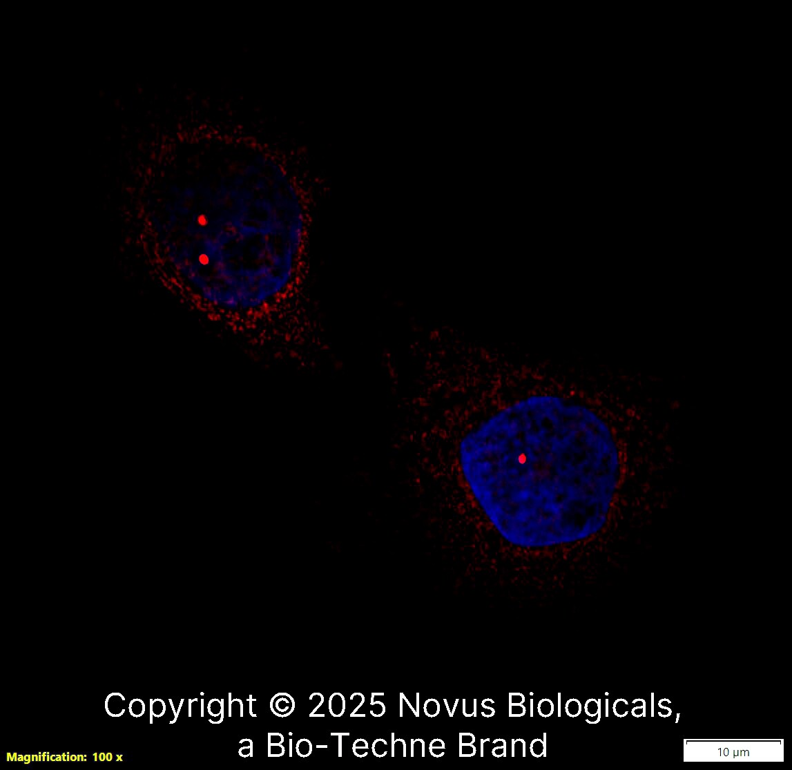SMN Antibody (2B1) [Biotin]