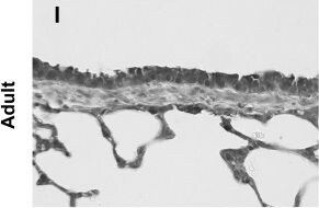 SOD2/Mn-SOD Antibody