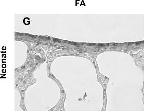 SOD2/Mn-SOD Antibody