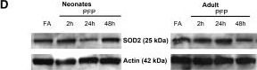 SOD2/Mn-SOD Antibody