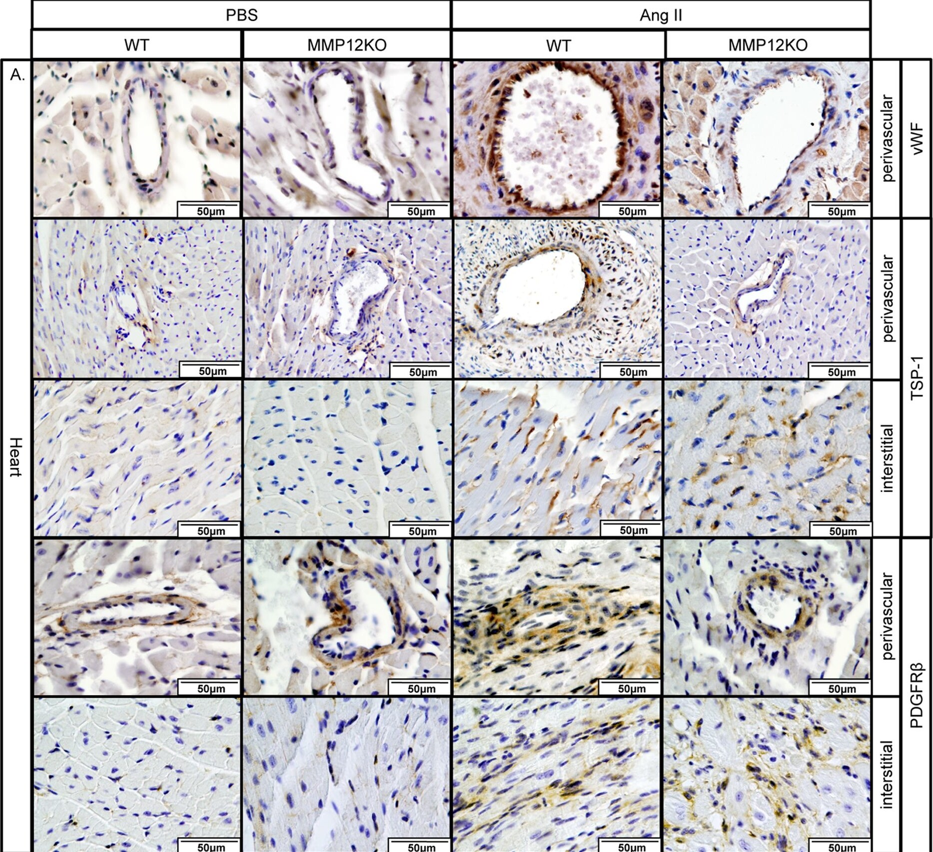 Thrombospondin-1 Antibody (A6.1)