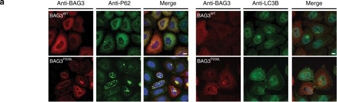 ATM Antibody (5C2)
