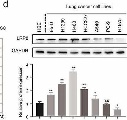 Apolipoprotein E R2/ApoE R2 Antibody - BSA Free