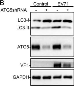 LC3B Antibody - BSA Free