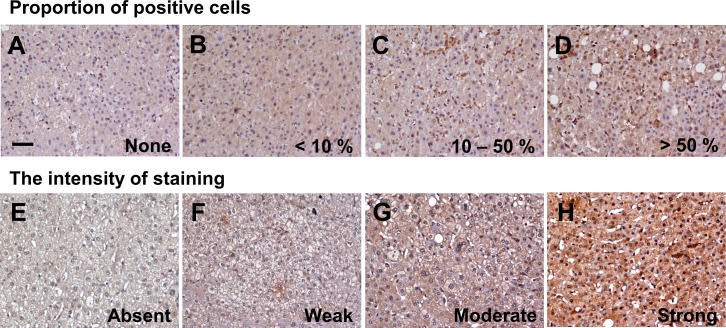LC3B Antibody - BSA Free