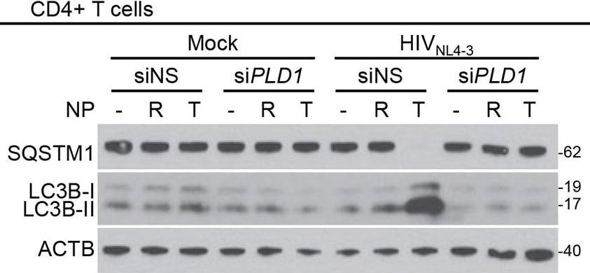 LC3B Antibody - BSA Free