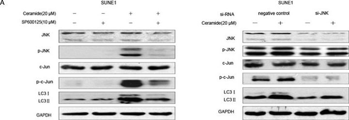 LC3B Antibody - BSA Free