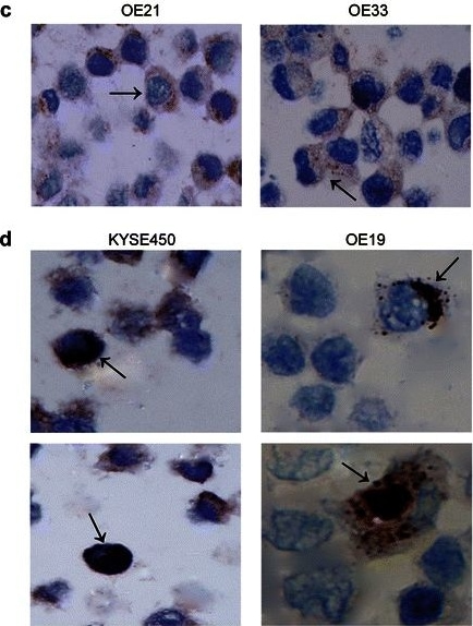 LC3B Antibody - BSA Free