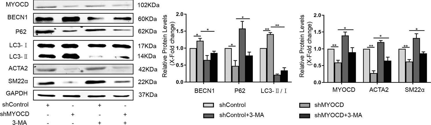 LC3B Antibody - BSA Free