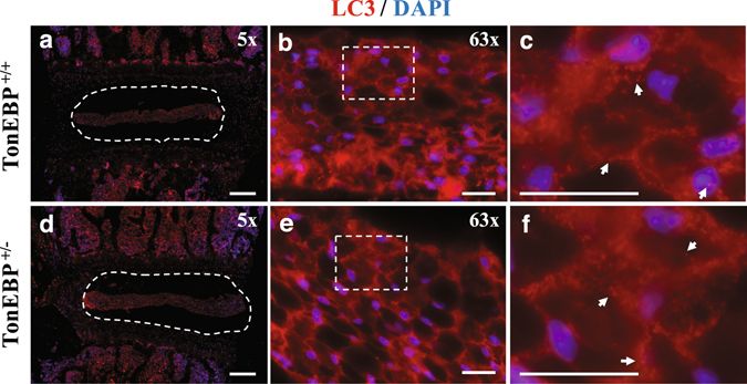 LC3B Antibody - BSA Free