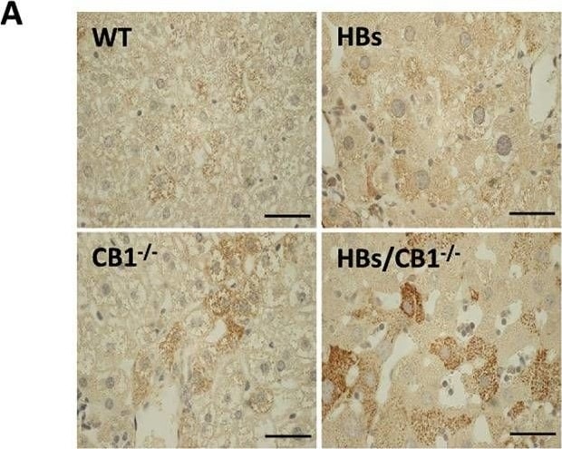 LC3B Antibody - BSA Free