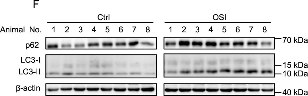 LC3B Antibody - BSA Free