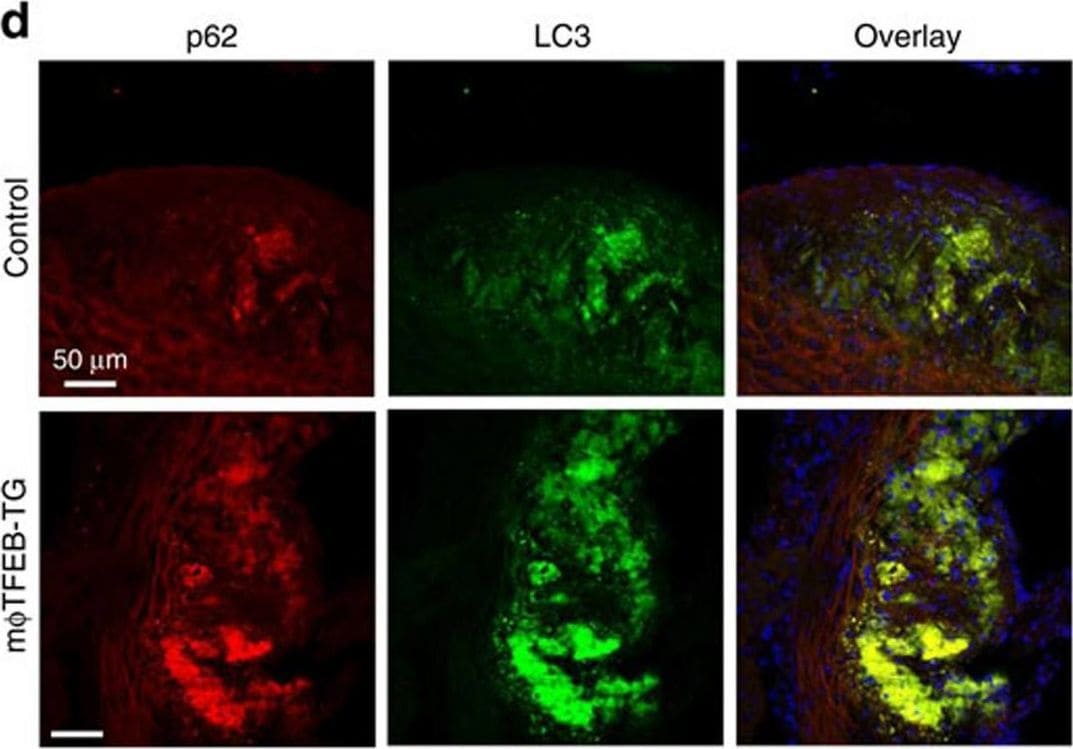 LC3B Antibody - BSA Free