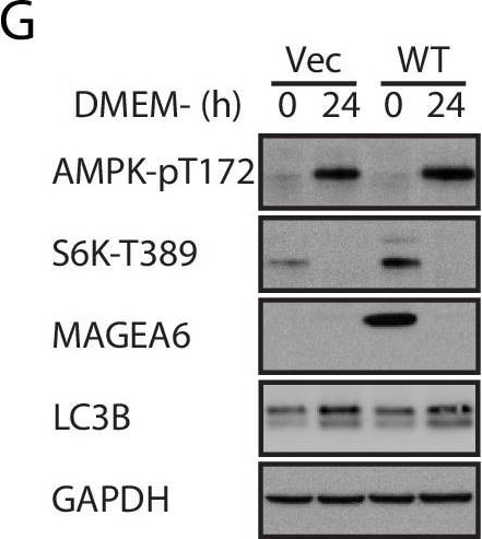 LC3B Antibody - BSA Free