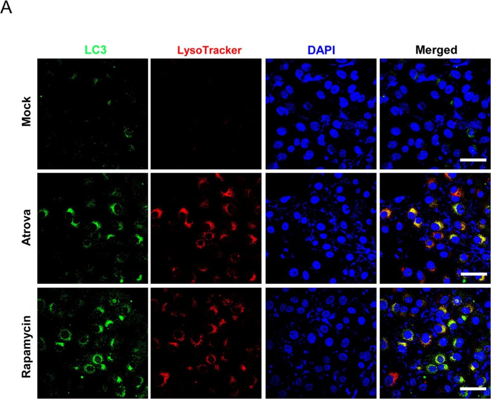LC3B Antibody - BSA Free