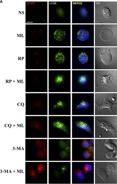 LC3B Antibody - BSA Free