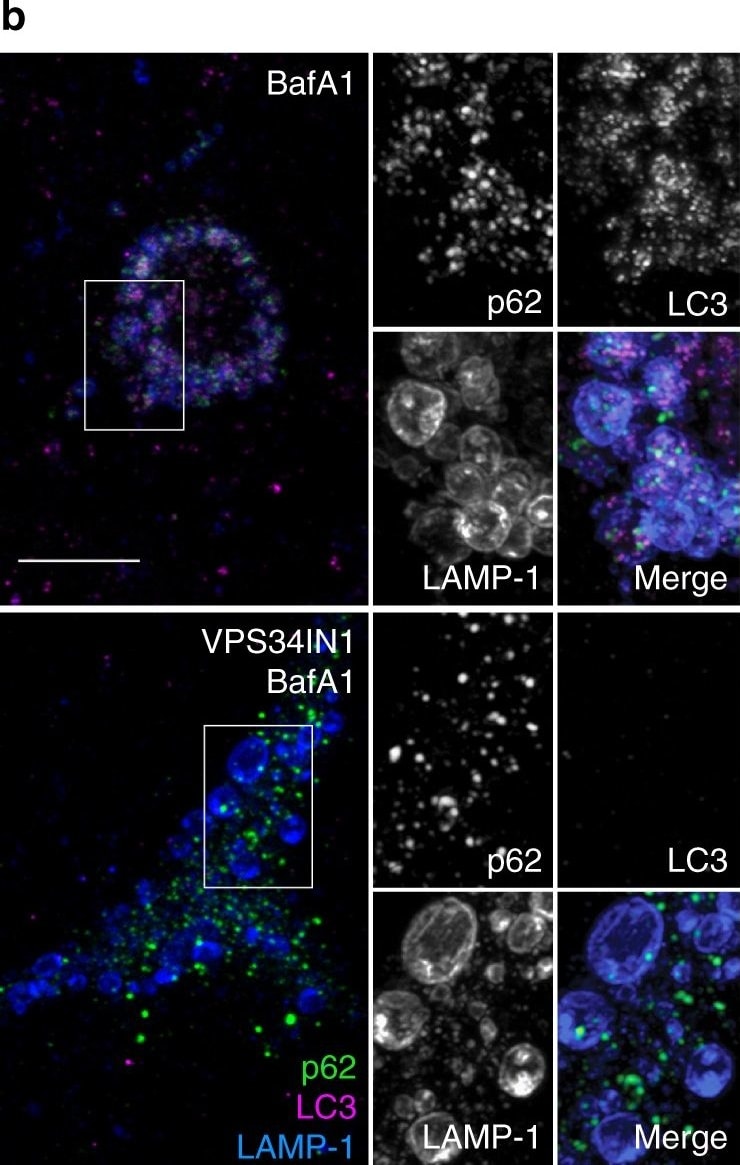 LC3B Antibody - BSA Free