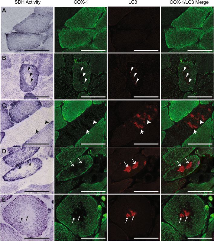 LC3B Antibody - BSA Free