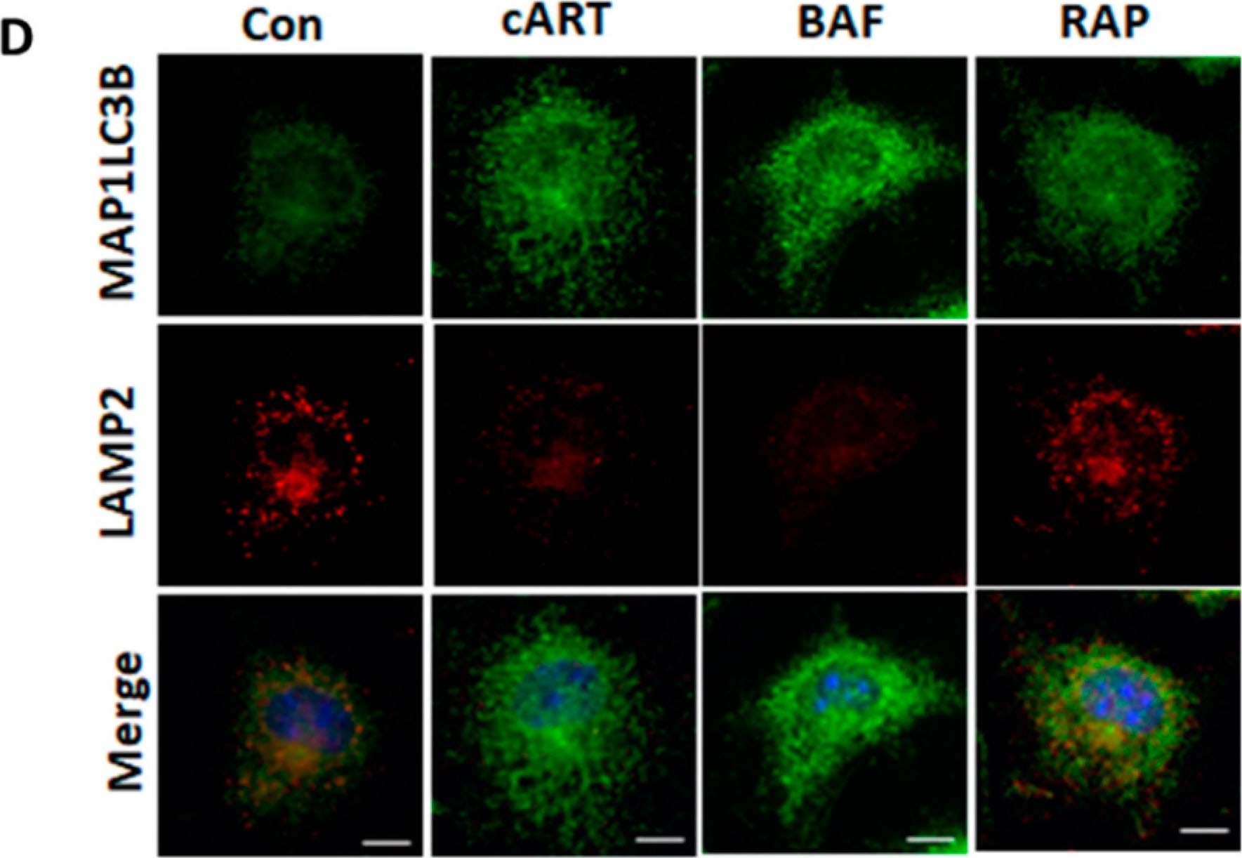 LC3B Antibody - BSA Free