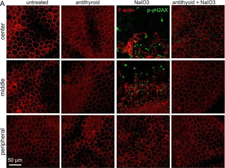 Histone H2AX [p Ser139] Antibody