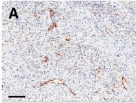 CD31/PECAM-1 Antibody