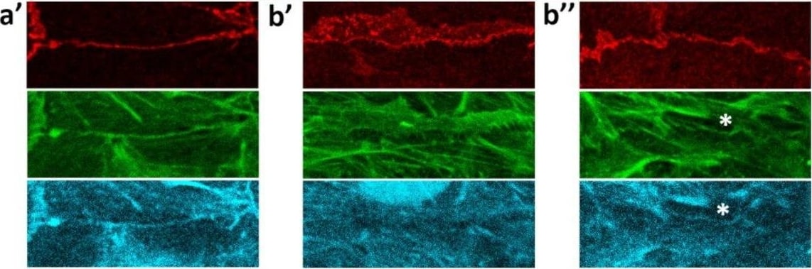 EPLIN Antibody