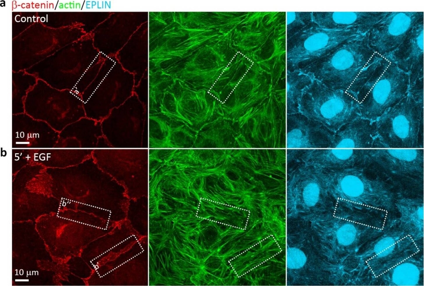 EPLIN Antibody