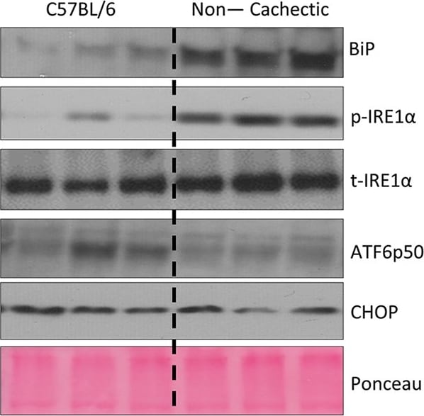 IRE1 alpha [p Ser724] Antibody - BSA Free