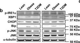 IRE1 alpha [p Ser724] Antibody - BSA Free