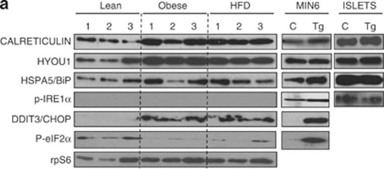 IRE1 alpha [p Ser724] Antibody - BSA Free