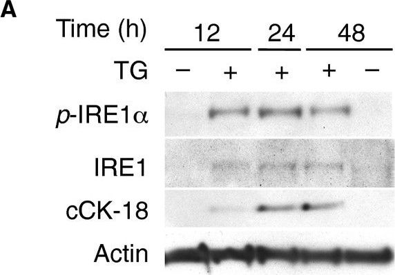 IRE1 alpha [p Ser724] Antibody - BSA Free