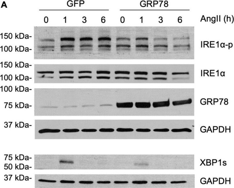 IRE1 alpha [p Ser724] Antibody - BSA Free