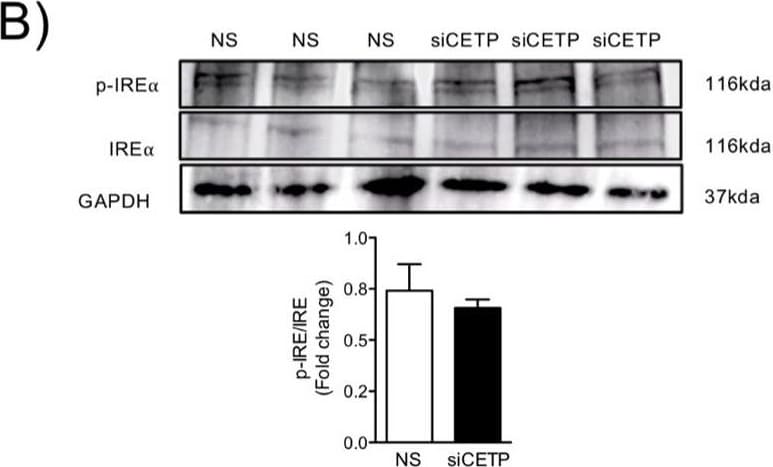 IRE1 alpha [p Ser724] Antibody - BSA Free
