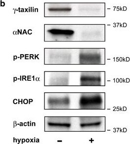 IRE1 alpha [p Ser724] Antibody - BSA Free