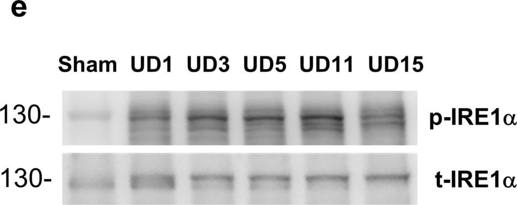 IRE1 alpha [p Ser724] Antibody - BSA Free