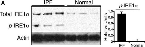 IRE1 alpha [p Ser724] Antibody - BSA Free
