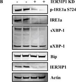 IRE1 alpha [p Ser724] Antibody - BSA Free