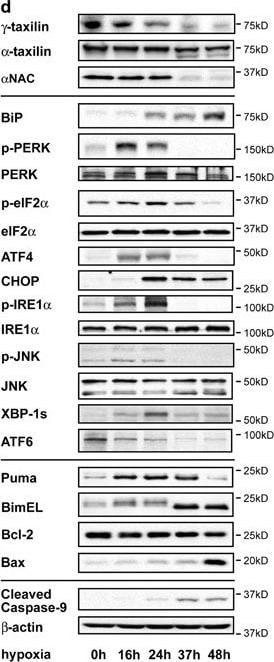 IRE1 alpha [p Ser724] Antibody - BSA Free