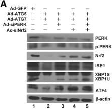 IRE1 alpha [p Ser724] Antibody - BSA Free