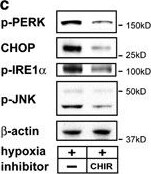 IRE1 alpha [p Ser724] Antibody - BSA Free