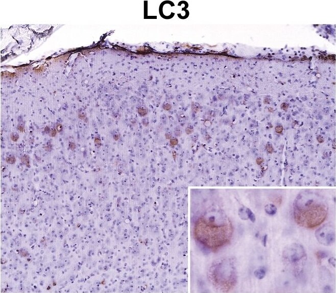 LC3A Antibody - BSA Free
