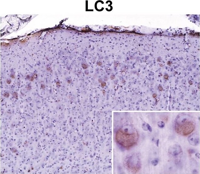 LC3A Antibody - BSA Free