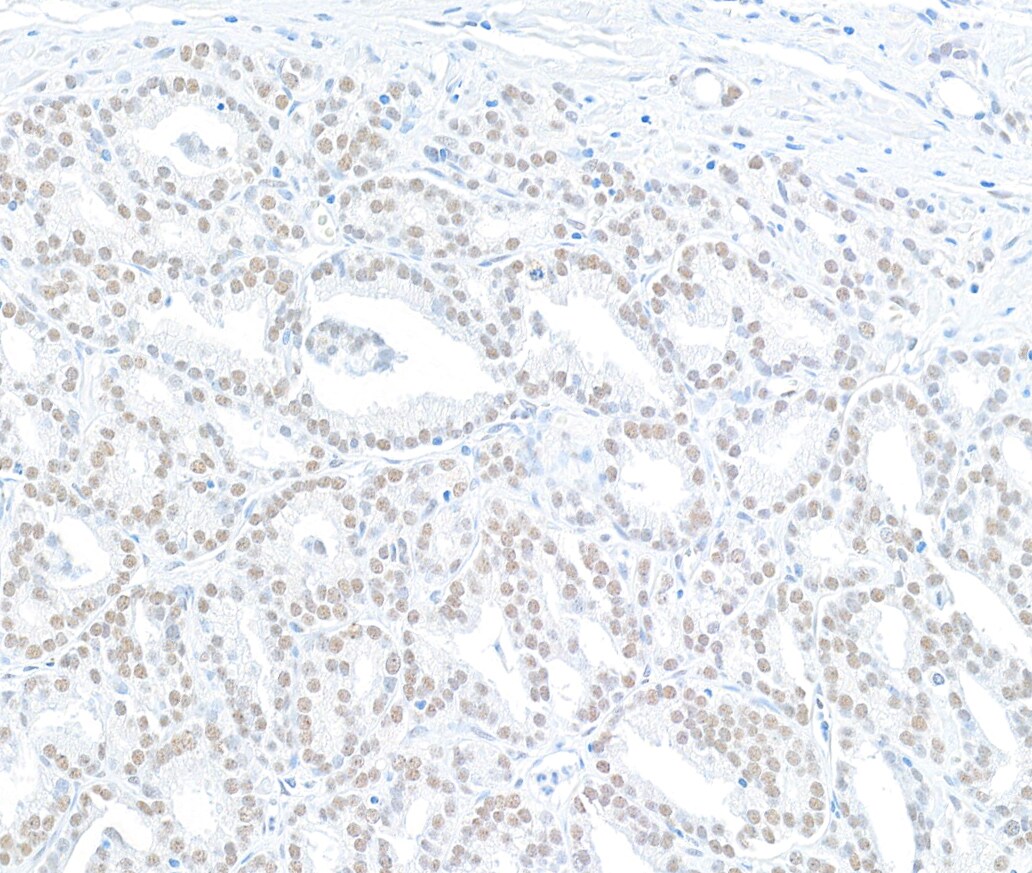 MED12 Antibody