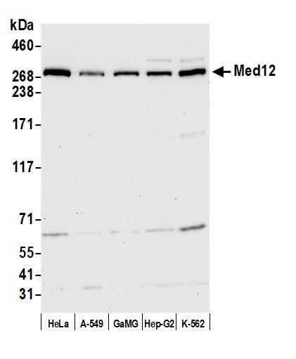 MED12 Antibody