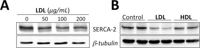 SERCA2 ATPase Antibody