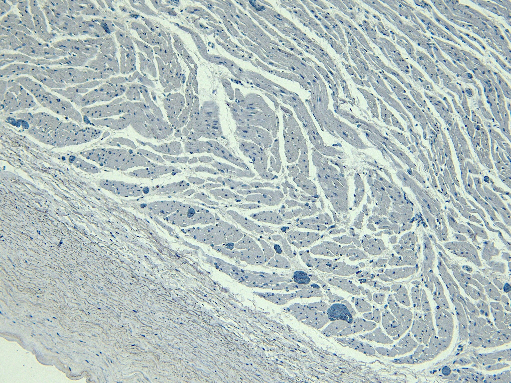 LDB3 Antibody