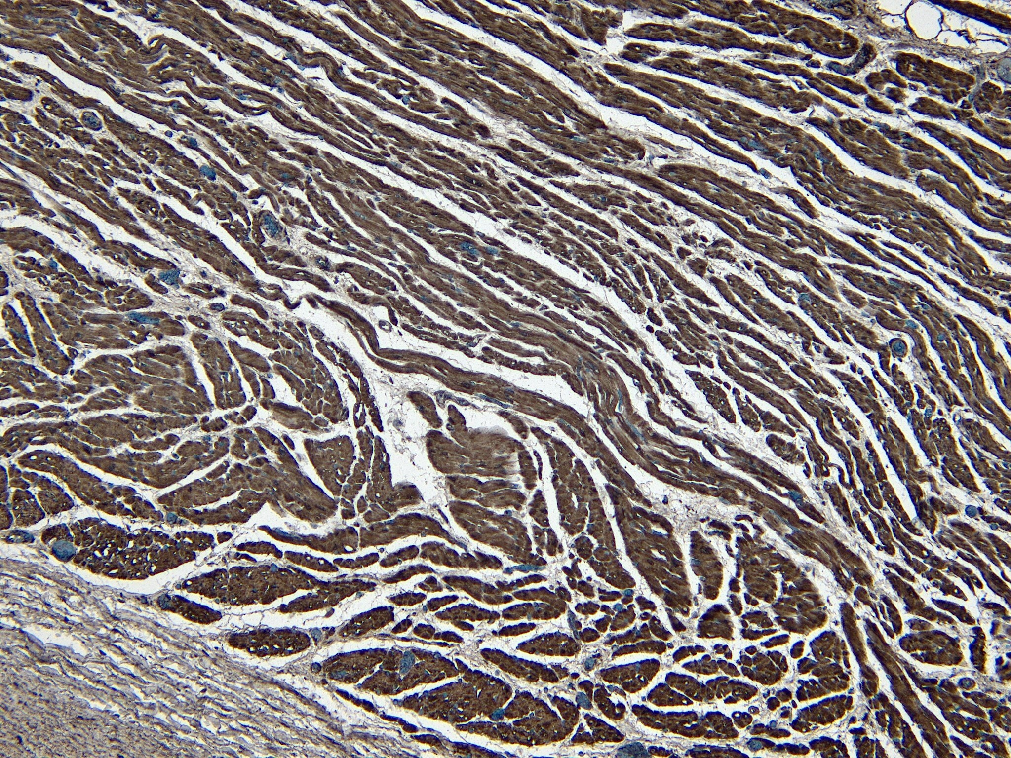 LDB3 Antibody