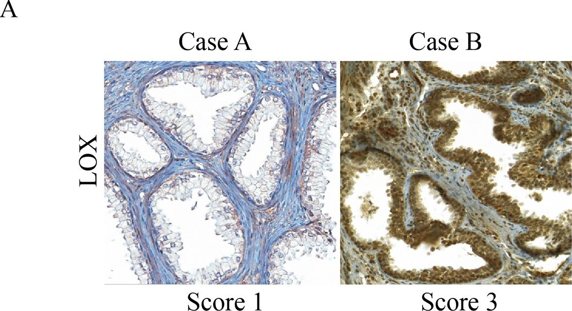 LOX Antibody - BSA Free